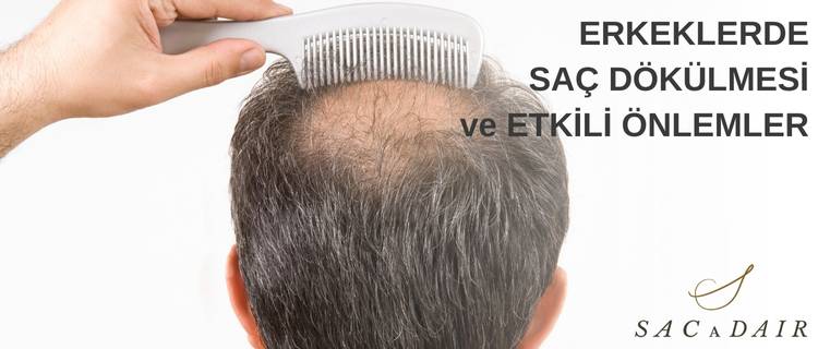 Erkeklerde Saç Dökülmesi ve Etkili Önlemler