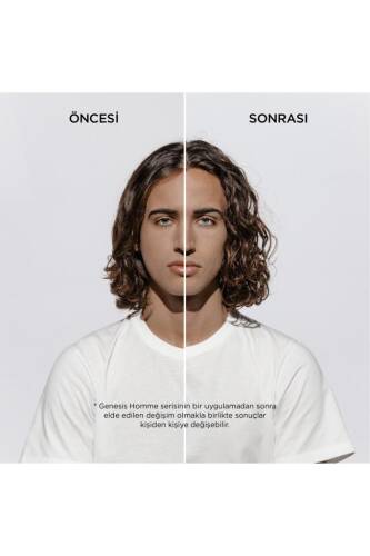 Genesis Homme Erkekler Için Dökülme Karşıtı Hediyeli Saç Bakım Seti - 5
