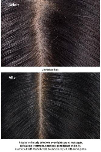 Aveda Scalp Solutions Saç Derisi Için Şampuan 200ml 018084040546 - 6