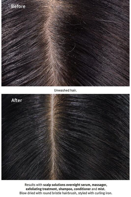 Aveda Scalp Solutions Saç Derisi Için Şampuan 200ml 018084040546 - 6
